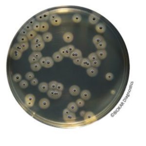 BAIRD-PARKER RPF AGAR