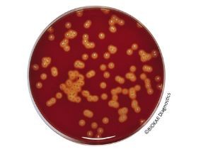Tryptone-Soy Agar (Blood Agar base)