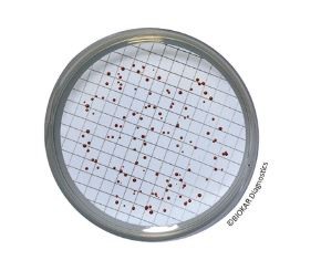 SLANETZ and BARTLEY Agar - Dehydrated base medium