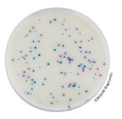 Salmonella Enrichment