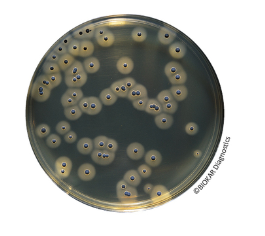 Rabbit Plasma Fibrinogen (RPF) supplement