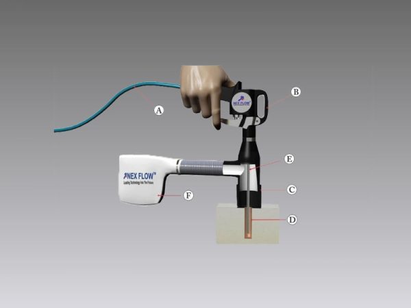 Blind Hole Cleaning System