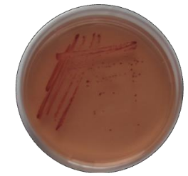 Enterococci Selective Agar