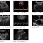 4D COLOR DOPPLER ULTRASOUND DIAGNOSIS SYSTEM PT400