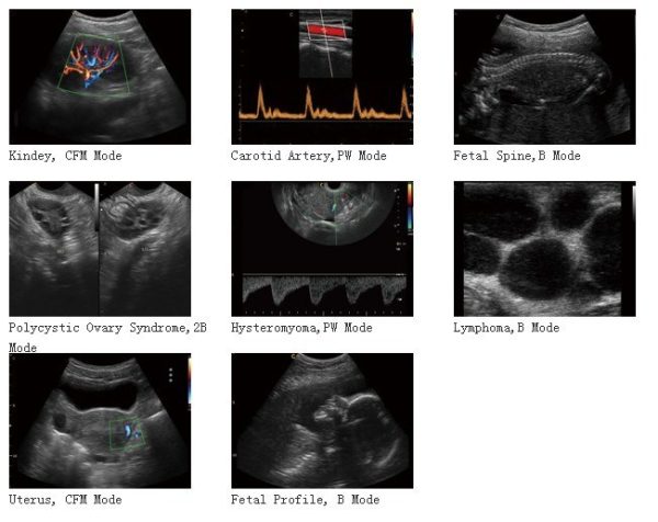 4D COLOR DOPPLER ULTRASOUND DIAGNOSIS SYSTEM PT400