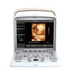 PORTABLE COLOR DOPPLER PT405